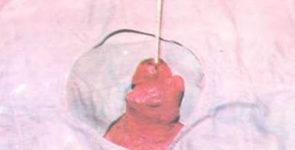 La cara de una persona

Descripción generada automáticamente con confianza baja