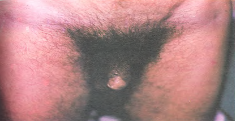 Imagen que contiene tatuaje, hombre, persona, interior

Descripción generada automáticamente