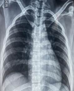 Persona con corbata

Descripción generada automáticamente con confianza baja