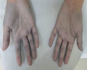 Mano de una persona

Descripción generada automáticamente con confianza media